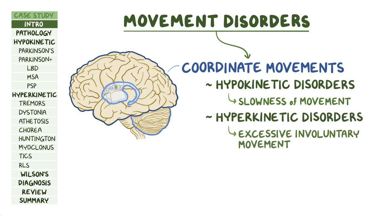 Movement Disorder