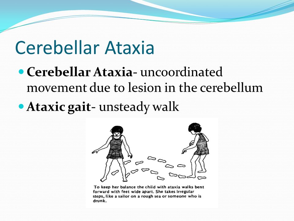 Ataxia