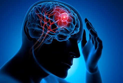 Brain Tumor